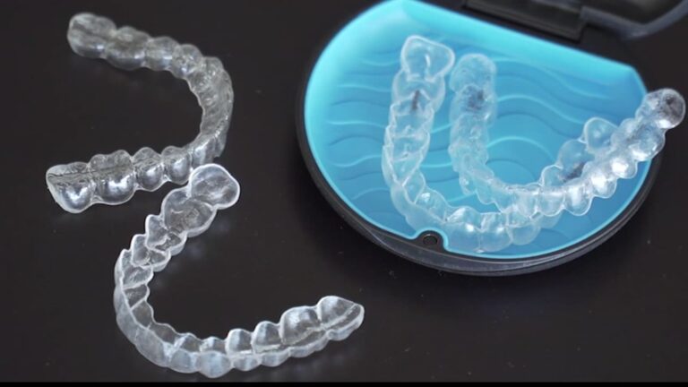Quanto custa o Invisalign​